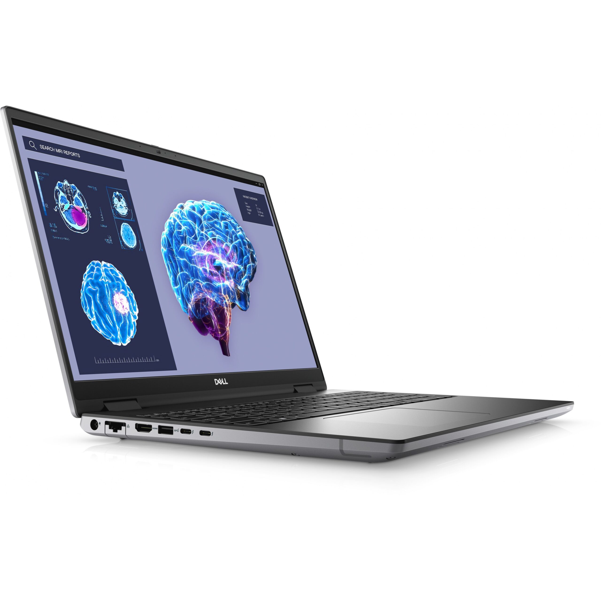 Laptop Dell Precision 7680 / i7-13850HX / 32GB DDR5 / 1TB / 16" Full HD+ WLED / RTX 3500 Ada 12GB- Gri - Figura 2