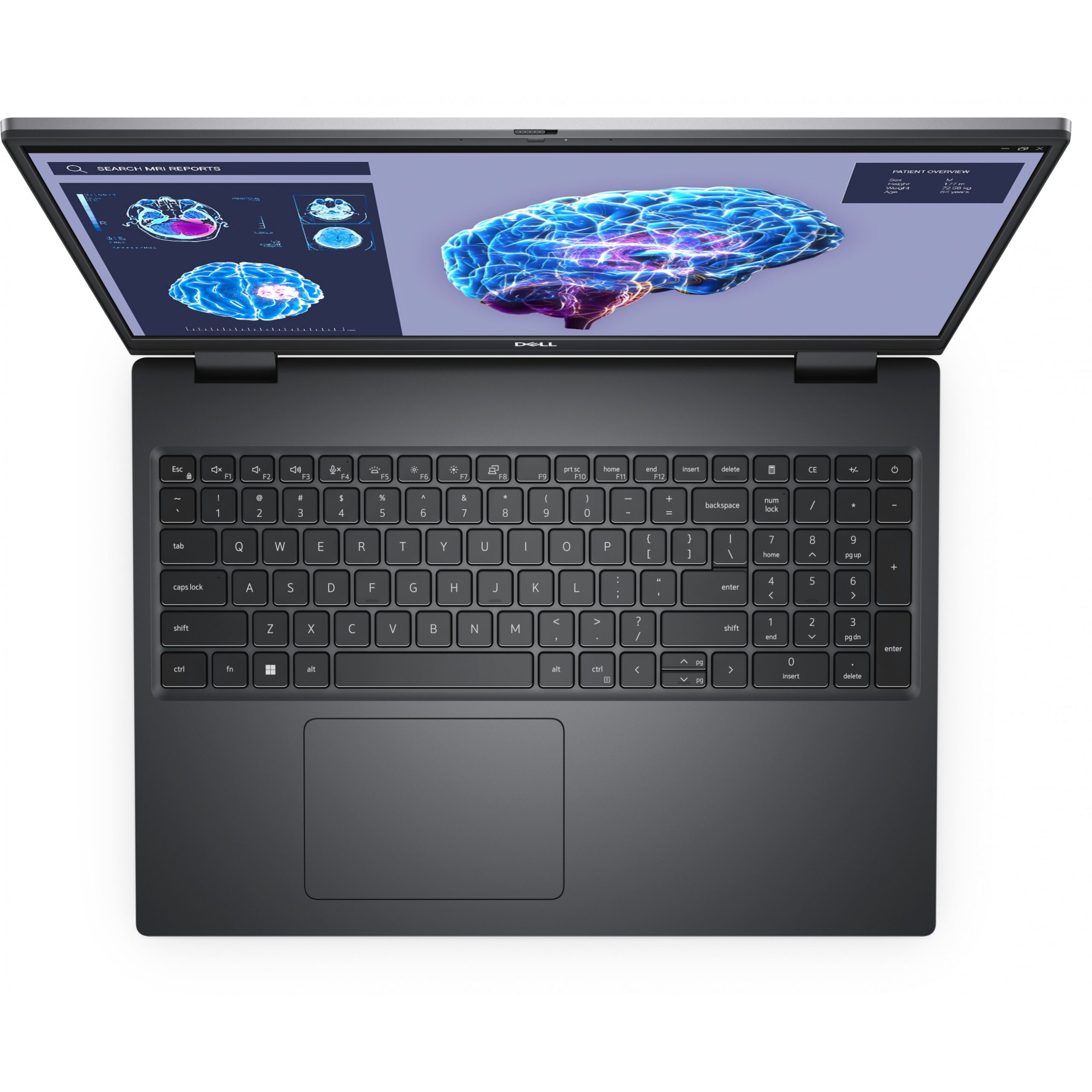 Laptop Dell Precision 7680 / i7-13850HX / 32GB DDR5 / 1TB / 16" Full HD+ WLED / RTX 3500 Ada 12GB- Gri - Figura 4