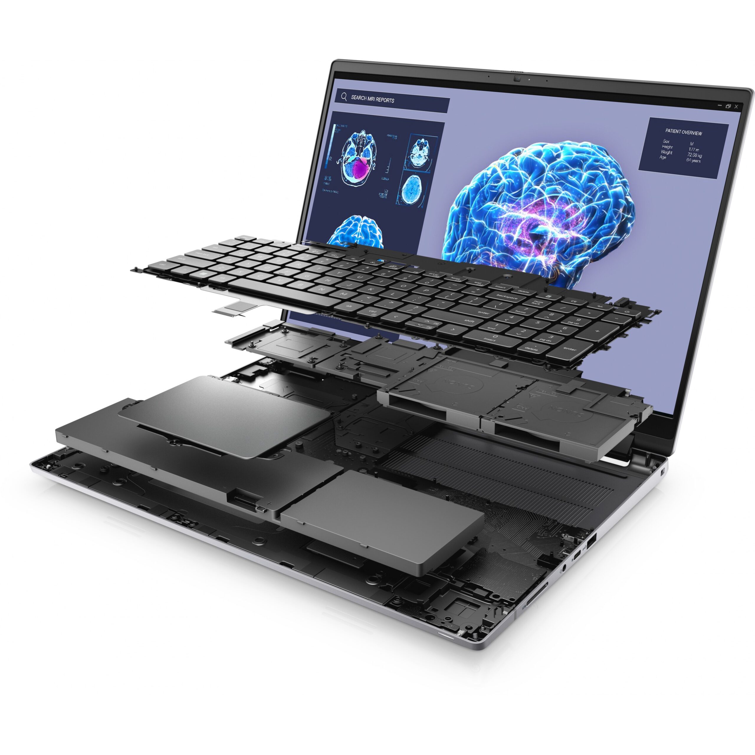 Laptop Dell Precision 7680 / i7-13850HX / 32GB DDR5 / 1TB / 16" Full HD+ WLED / RTX 3500 Ada 12GB- Gri - Figura 5